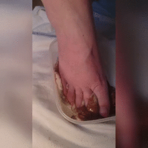 Major L. reccomend foot fetish peeling skin