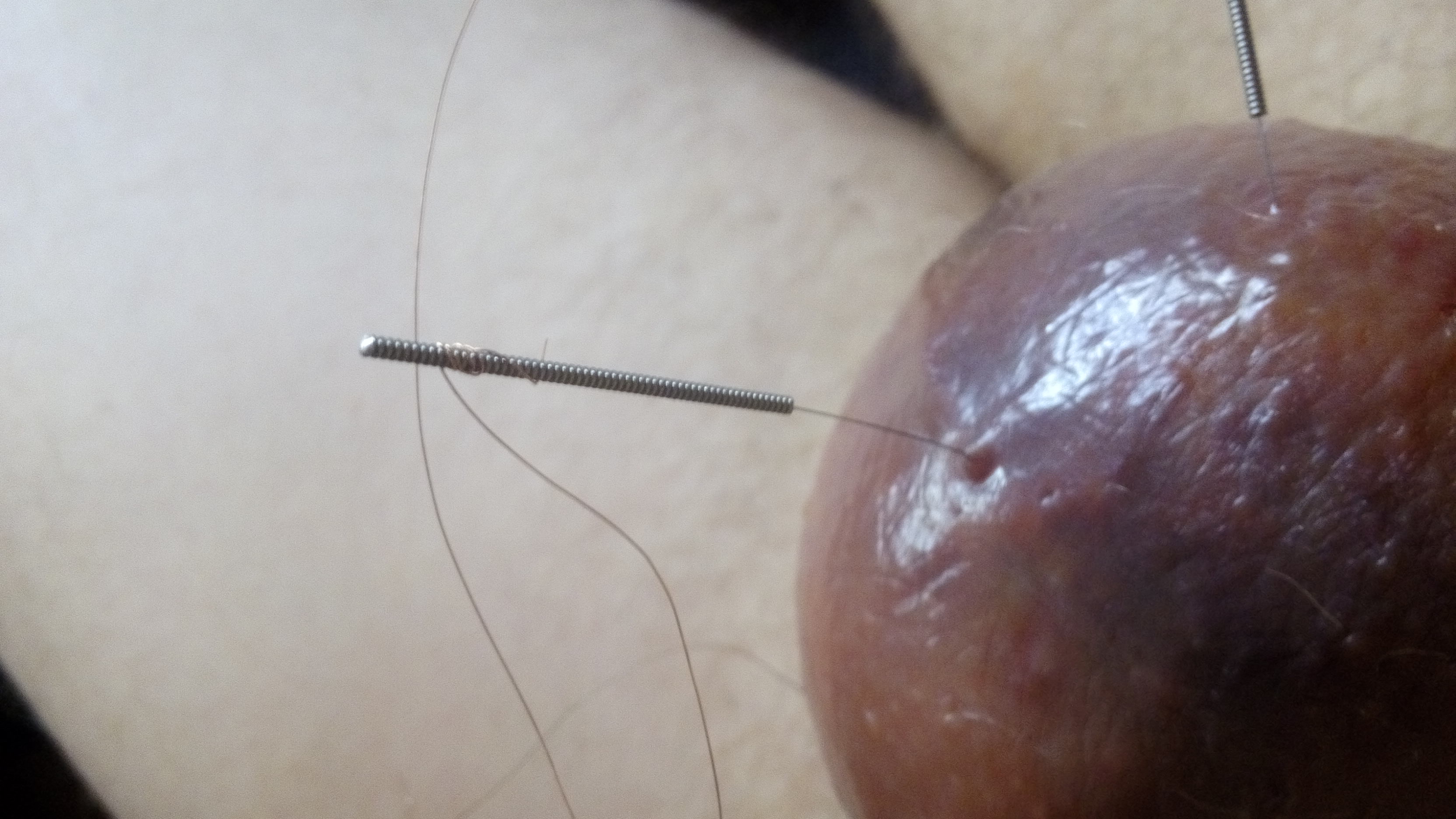 Hydraulics reccomend electro balls estim needles
