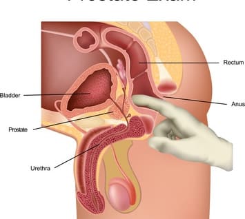 Boomerang recommend best of prostata spielzeug massiert saft seiner finger